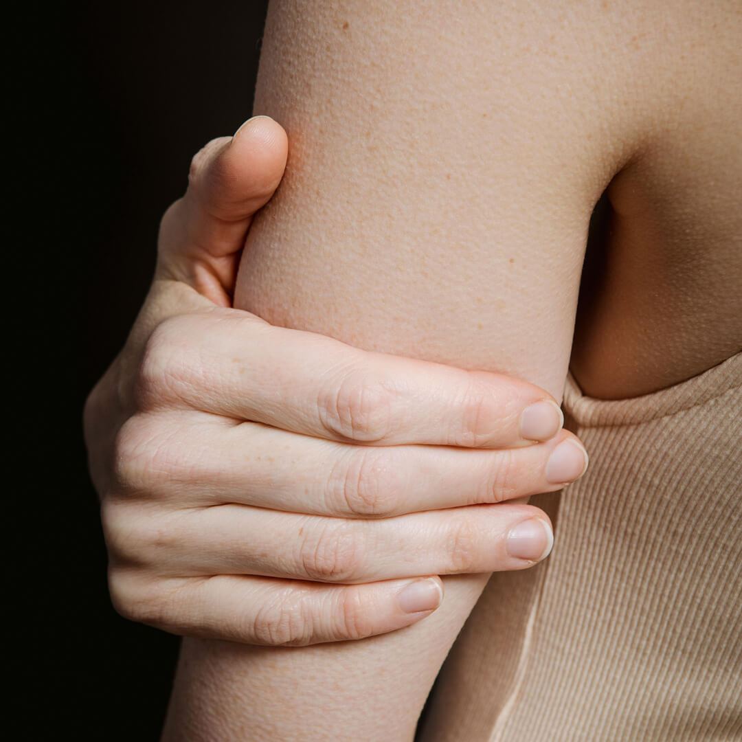 Reibeisenhaut – Hand an Arm Symbolbild