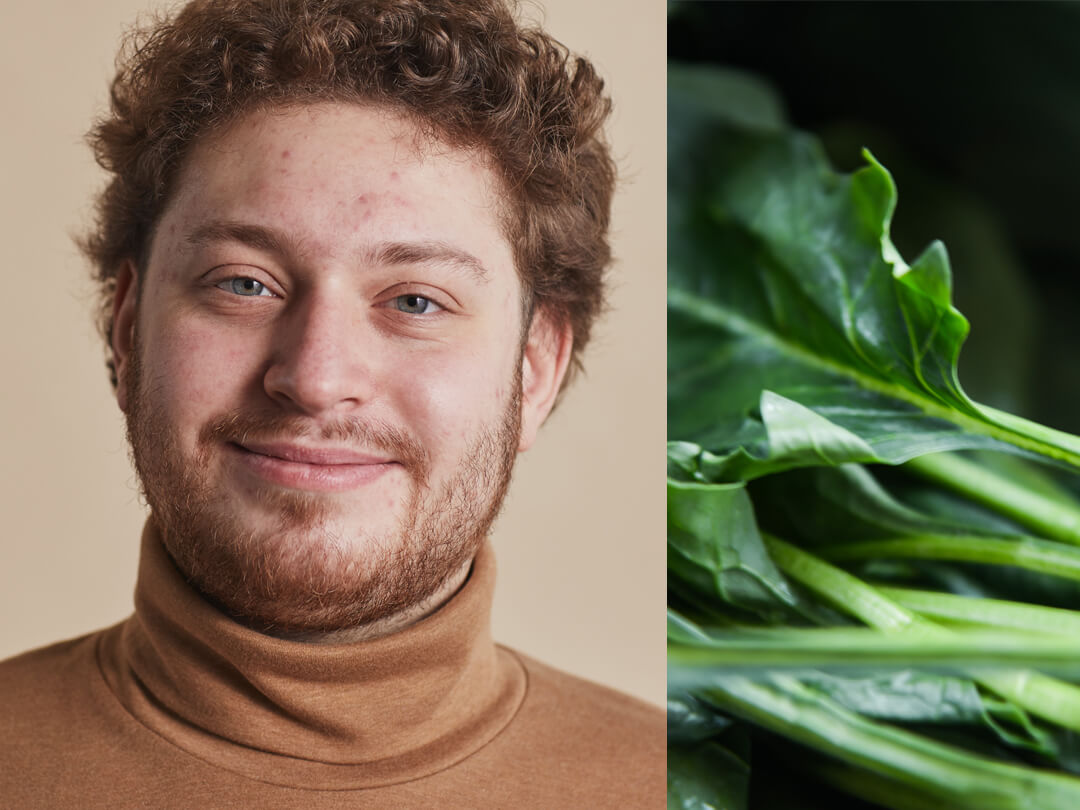 Ernährung gegen Pickel: So wirst du Unreinheiten los